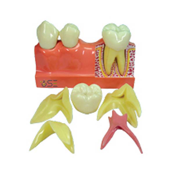 4 times Disassembling Teeth Model
